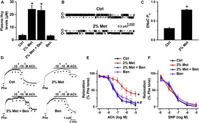 Homocysteine Causes Endothelial Dysfunction via Inflammatory Factor-Mediated Activation of Epithelial Sodium Channel (ENaC)